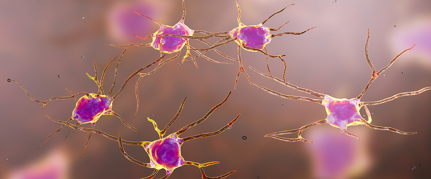 Chronic Stress Drives Immune Cells to Remodel Neural Circuits, Possibly Promoting Anxiety and Depression
Chronic Stress Drives Immune Cells to Remodel Neural Circuits, Possibly Promoting Anxiety and Depression