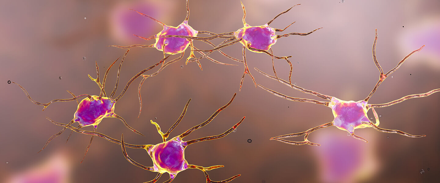 Activating Specific Serotonin Neurons Reduced Anxiety and Promoted Sleep in Mice
Activating Specific Serotonin Neurons Reduced Anxiety and Promoted Sleep in Mice